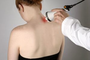 Liệu pháp laser