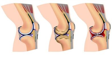 Các giai đoạn phát triển của khớp đầu gối
